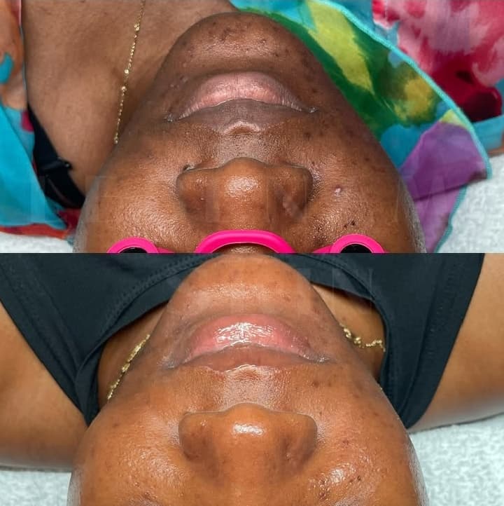 Lebenam Skin  - Image 5