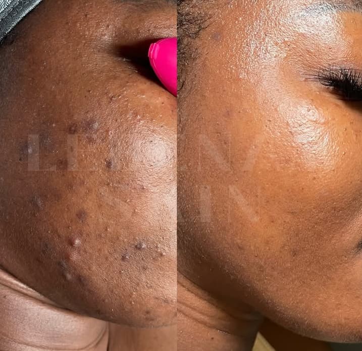 Lebenam Skin  - Image 2