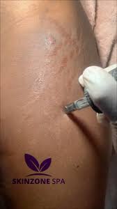 Skinzone Spa - Image 4