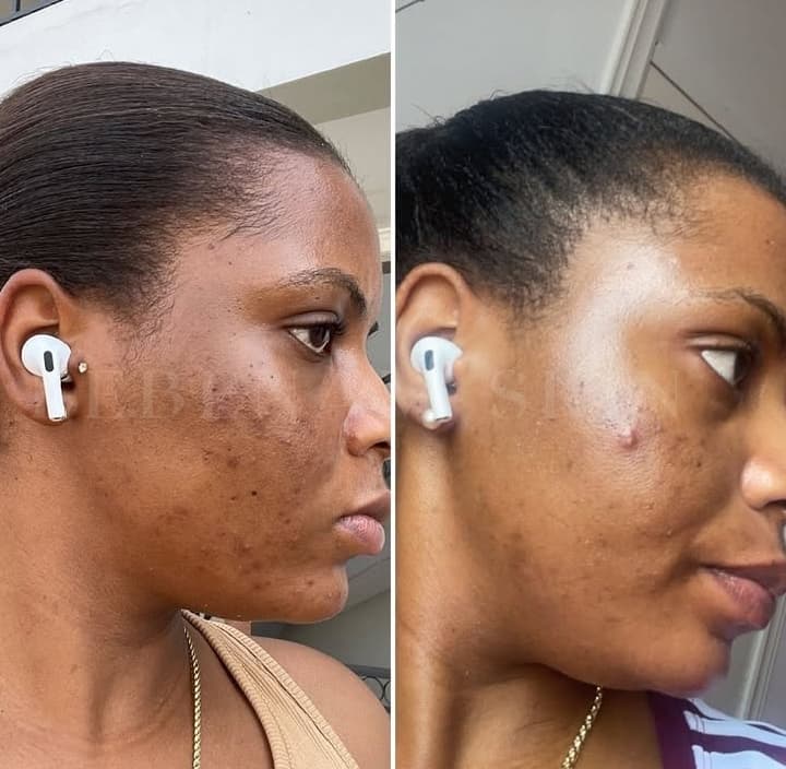 Lebenam Skin  - Image 3