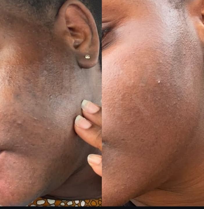 Lebenam Skin  - Image 4