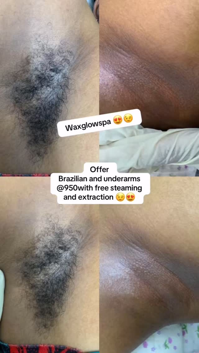 Brazilian waxing  & Underarm Waxing